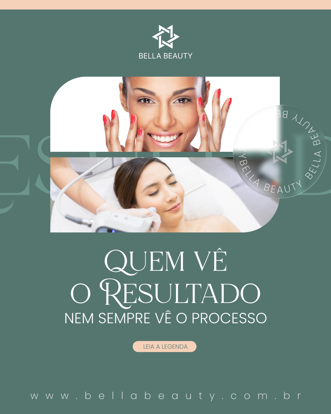 Estética Post 2